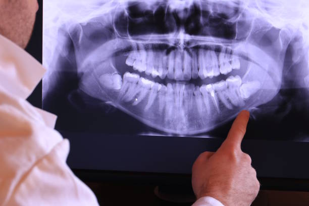 Best Teeth Whitening  in Doylestown, OH